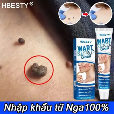Kem Mụn Cóc, Mụn Thịt, Mụn Cơm Hiệu Quả – Chiết Xuất Thảo Dược An Toàn 20g, ĐÈN TRANG TRÍ , ĐỒNG HỒ TREO TƯỜNG