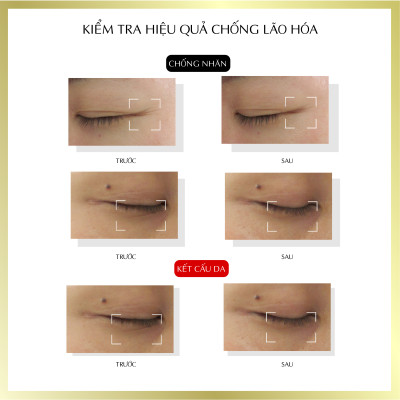 Tinh chất  tế bào gốc dưỡng ẩm chuyên sâu Harinista Delivery Essence 30ml