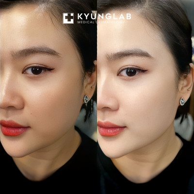 Kem Dưỡng Nâng Tone Ban Ngày Kyung Lab 50ml