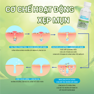 Chấm mụn Tràm Trà giảm mụn nhanh sau 1 đêm dành cho da mụn sưng viêm Bye Bye Blemish Tea Tree Drying Lotion 30ml