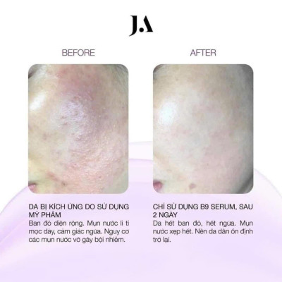 Serum Giảm Kích Ứng Juliette Armand Folic Acid B9