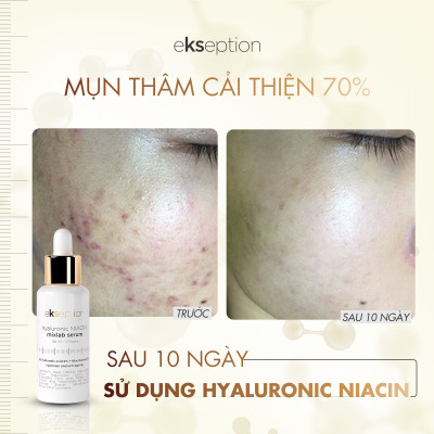 Serum giảm mụn, xóa thâm Ekseption HYALURONIC NIACIN MIXLAB SERUM - 50ml duy trì độ ẩm cho làn da, giúp làm sáng da và mịn da