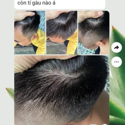 Gội Gàu Nấm Dr Cell 250ml hỗ trợ làm sạch gàu nấm da đầu dưỡng tóc hỗ trợ mọc tóc con giảm rụng tóc - Hàng Chính Hãng