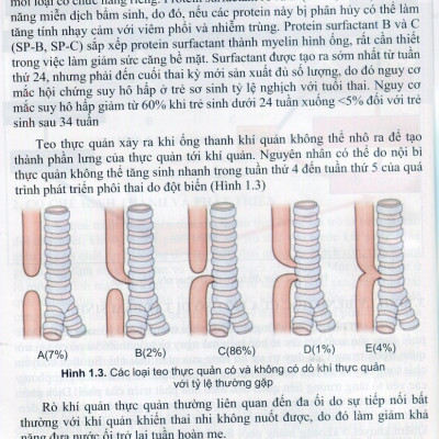 Sách - Tiếp cận chẩn đoán và đ.iều trị bệnh hô hấp trẻ em (Y)