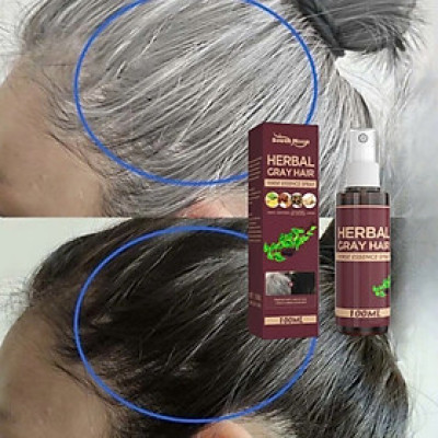 Làm Đen Tóc Vĩnh Viễn Với Thảo Dược – Dưỡng Chất 100ml Cho Mái Tóc Luôn Đen Óng Mượt , đèn ốp trần