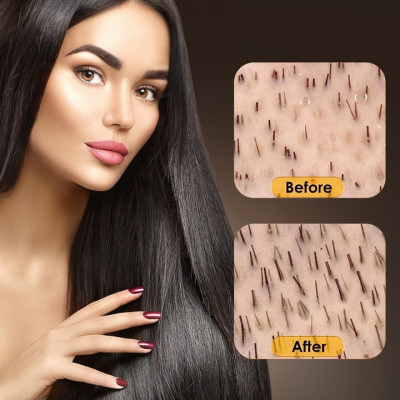 Chai xịt dưỡng kích mọc tóc, giúp tóc mọc dài nhiều và dày, mọc tóc nhanh, bóng, mượt, ngăn rụng tóc xuất xứ Singapore - Mã số 1102