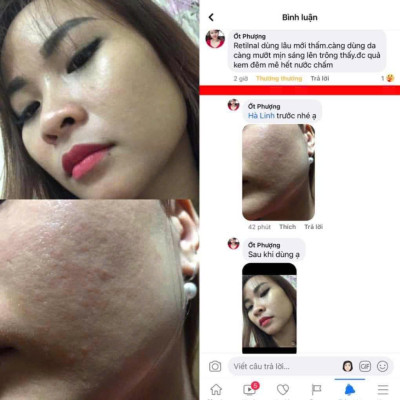 Kem đêm retinal 1.0 Kr.lab Vitamin A night cream Retinal plus 7 vitamin supplier hạn dùng 2026