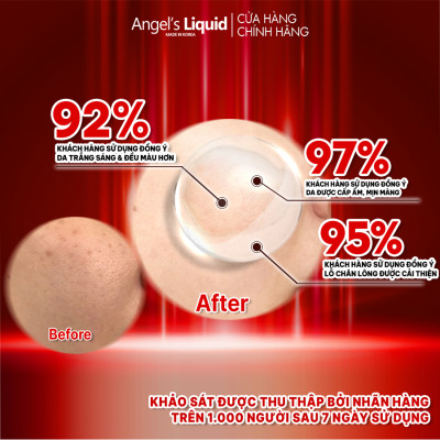 Tinh Chất Truyền Trắng Angel