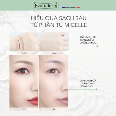 Nước tẩy trang Evoluderm Eau Micellaire 500ml