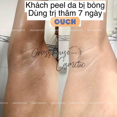 SERUM MỜ THÂM NÁM DƯỠNG DA TRẮNG SÁNG CHO DA MẶT - DA BIKINI THE RENEWAL  20ML