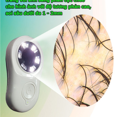 Dermoscopy - Thiết bị soi da tích hợp điện thoại và máy tính bảng MoleScope II