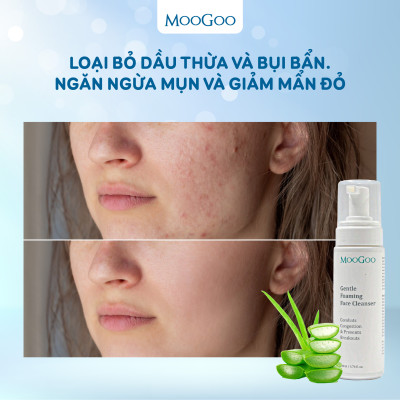 Sữa rửa mặt tạo bọt chiết xuất đu đủ cho da nhạy cảm, da mụn ko SLS, Sulffate Moogoo Úc
