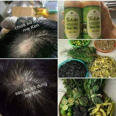 COMBO 2 CHAI TINH CHẤT GỘI ĐẦU THẢO MỘC MẸ KEN-MỖI CHAI 500ml