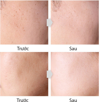 Combo chăm sóc da cao cấp Hàn Quốc The Rucy gồm Sữa rửa mặt trà xanh 150ml và Kem chống nắng vật lý SPF 50+/PA+++ 50ml