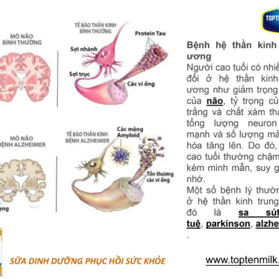 Sữa bột tăng cân,hổ trợ tiêu hóa healthy 400g TOPTEN Milk